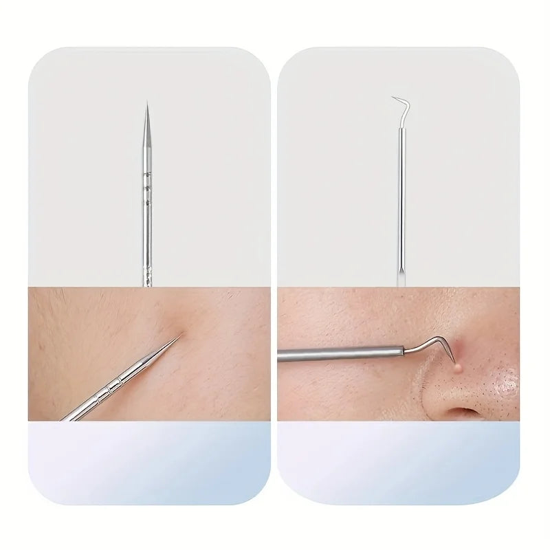 Stainless Steel 4/7/8pcs Acne Removal Tool Set - Blackhead & Pimple Popper Kit for All Skin Types, Fragrance-Free, Beauty Tools