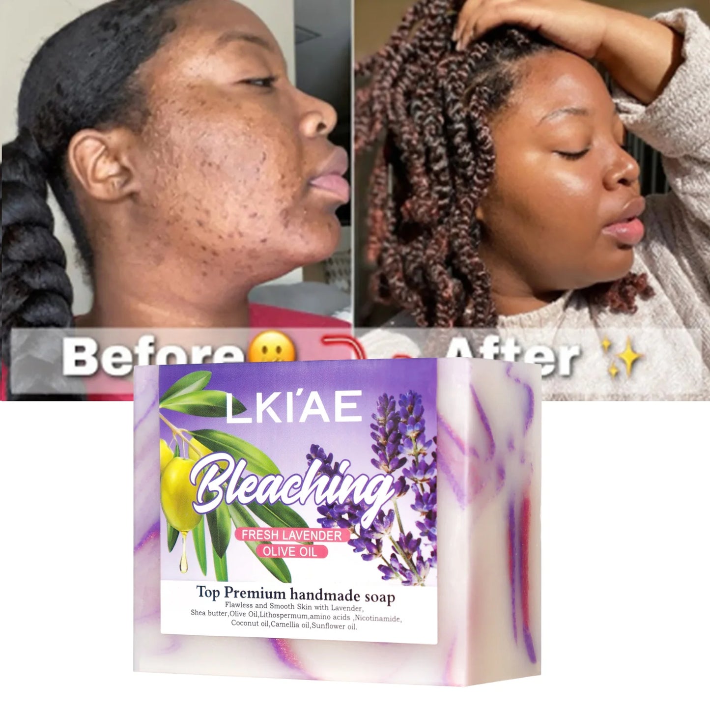 Fresh Lavender Oil Soap Bar, Whitening, Reduce Acne, Smooth Skin, With Niacinamide, Glutathione, For All Skin Types, 150g/5.3 oz