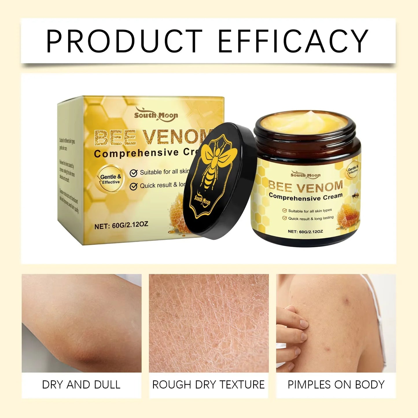 South Moon Bee Venom Skin Moisturizer Nourish Dryness Anti Cellulite Keep Brighten Improve Sagging Reduce Dull Body Care Creams